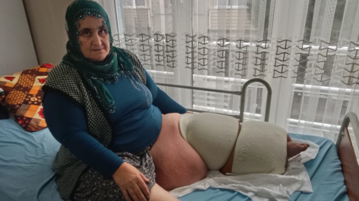 Mersin’de fil hastalığıyla mücadele ediyor